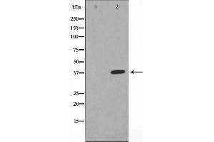 Western Blotting (WB) image for anti-X-Ray Repair Complementing Defective Repair in Chinese Hamster Cells 3 (XRCC3) (N-Term) antibody (ABIN6266068)