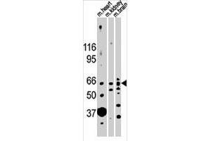 Western blot analysis of ACVR2B polyclonal antibody  in mouse heart, kidney and brain lysates (35 ug/lane). (ACVR2B antibody  (N-Term))