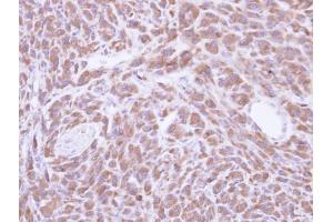 IHC-P Image Immunohistochemical analysis of paraffin-embedded U87 xenograft, using PCMT1, antibody at 1:500 dilution. (PCMT1 antibody)