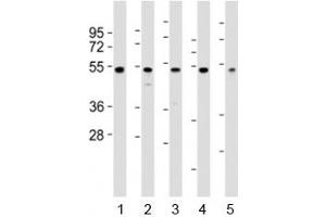 Western blot testing of NFKBIE antibody at 1:2000 dilution.