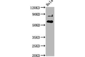 Western Blot Positive WB detected in Hela whole cell lysate All lanes Phospho-AKT1 antibody at 2. (Recombinant AKT1 antibody  (pThr450))