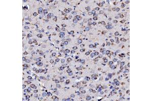 IHC analysis of MPPB/PMPCB using anti-MPPB/PMPCB antibody (ABIN7600758).