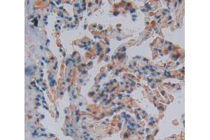 Figure. (CRIP1 antibody  (AA 2-77))