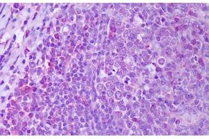 Anti-RANKL antibody IHC staining of human tonsil, germinal center. (RANKL antibody)