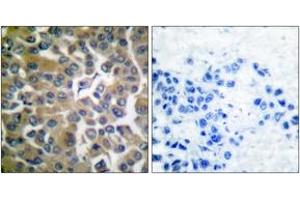 Immunohistochemistry (IHC) image for anti-Fibroblast Activation Protein, alpha (FAP) (AA 331-380) antibody (ABIN1533269)