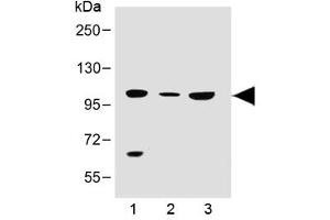 Western blot testing of human 1) 293T/17, 2) brain and 3) K562 lysate with SLC14A2 antibody at 1:500. (Solute Carrier Family 14 (Urea Transporter, Kidney) Member 2 (SLC14A2) (AA 42-76) antibody)