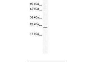 Image no. 1 for anti-BRF1, RNA polymerase III transcription initiation factor subunit (BRF1) (C-Term) antibody (ABIN202061) (BRF1 antibody  (C-Term))