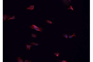 ABIN6266575 staining HeLa cells by IF/ICC. (Cytokeratin 7 antibody  (C-Term))