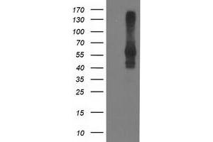 HEK293T cells were transfected with the pCMV6-ENTRY control (Left lane) or pCMV6-ENTRY DLD (Right lane) cDNA for 48 hrs and lysed. (DLD antibody)