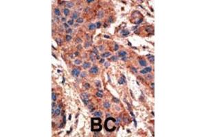 Immunohistochemistry (Paraffin-embedded Sections) (IHC (p)) image for anti-Bone Morphogenetic Protein Receptor 1A (BMPR1A) (AA 30-60), (N-Term) antibody (ABIN388732)