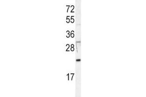 Western blot analysis of HRAS antibody in Jurkat lysate. (HRAS antibody  (AA 104-128))