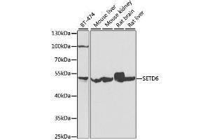 Western blot analysis of extracts of various cell lines, using SETD6 antibody. (SETD6 antibody  (AA 301-473))