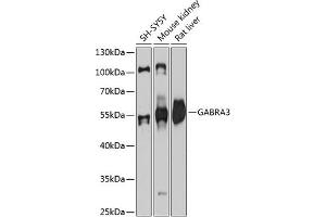 Western blot analysis of extracts of various cell lines, using G antibody (ABIN6131687, ABIN6140903, ABIN6140906 and ABIN6215329) at 1:3000 dilution. (GABRA3 antibody  (AA 29-276))