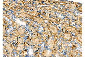 ABIN6257402 and ABIN6273969 at 1/100 staining Rat kidney tissue by IHC-P. (OR1J1 antibody  (Internal Region))