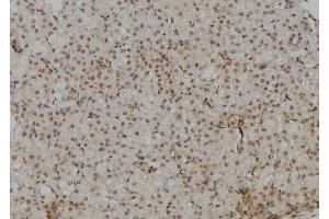 ABIN6277090 at 1/100 staining Rat kidney tissue by IHC-P.