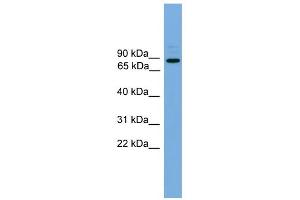 WB Suggested Anti-ARHGEF19 Antibody Titration: 0. (ARHGEF19 antibody  (Middle Region))