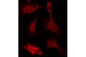 ABIN6267386 staining 293 by IF/ICC. (Ezrin antibody  (pTyr146))