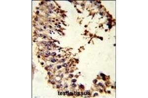 Formalin-fixed and paraffin-embedded human testis tissue reacted with ACR Antibody (Center), which was peroxidase-conjugated to the secondary antibody, followed by DAB staining. (Acrosin antibody  (AA 99-127))