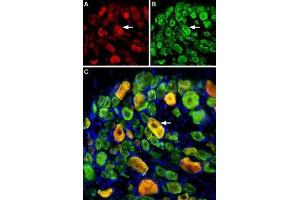 Multiplex staining of ASIC1 and ASIC3 in rat DRG - Immunohistochemical staining of perfusion-fixed frozen rat dorsal root ganglia (DRG) sections using Guinea pig Anti-ASIC1 Antibody (ABIN7042914, ABIN7045410 and ABIN7045411), (1:400) and rabbit Anti-ASIC3 Antibody (ABIN7042917, ABIN7045243 and ABIN7045244), (1:400). (ASIC3 antibody  (Intracellular, N-Term))