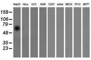 Image no. 2 for anti-Formiminotransferase Cyclodeaminase (FTCD) antibody (ABIN1496382) (FTCD antibody)