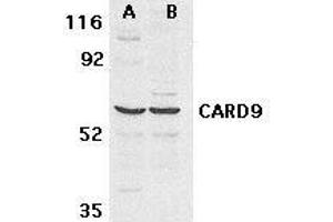 Western blot analysis of CARD9 expression in human MDA- MB-361 (A) and PC-3 (B) cell lysate withCARD9 antibody at 2. (CARD9 antibody)