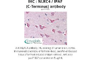 Image no. 1 for anti-NLR Family, CARD Domain Containing 4 (NLRC4) antibody (ABIN1737383) (NLRC4 antibody)