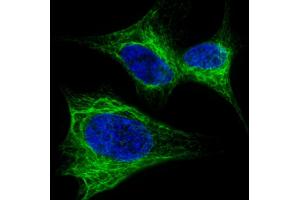 Fluorescent confocal image of SH-SY5Y cells stained with Nestin  antibody. (Nestin antibody  (AA 1389-1416))
