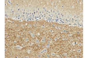 Immunohistochemical staining of rabbit brain using anti-SNAP25 antibody ABIN7072250 Formalin fixed rabbit brain slices were were stained with a ABIN7072250 at 3 μg/mL. (Recombinant SNAP25 antibody)