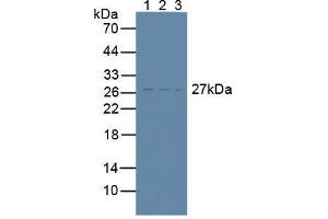 Western blot analysis of (1) Human Lymphocytes Cells, (2) Human U-87MG Cells and (3) Mouse RAW 2647 Cells. (CD81 antibody  (AA 113-201))