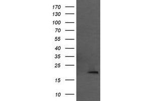 Image no. 1 for anti-Mitochondrial Ribosomal Protein L11 (MRPL11) antibody (ABIN1499556) (MRPL11 antibody)