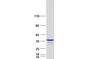 Validation with Western Blot (LHPP Protein (Myc-DYKDDDDK Tag))