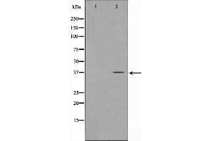 Western blot analysis on COS7 cell lysate using FOXL1 Antibody，The lane on the left is treated with the antigen-specific peptide. (FOXL1 antibody)
