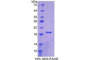 SDS-PAGE analysis of Rabbit SOD1 Protein. (SOD1 Protein (Soluble))