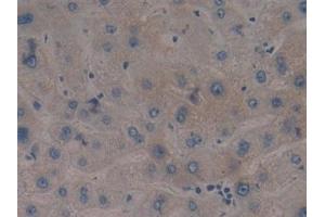 Immunohistochemistry (IHC) image for anti-Toll-Like Receptor 9 (TLR9) (AA 28-362) antibody (ABIN7432445)