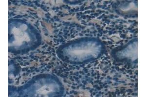 Detection of PSMC1 in Human Stomach Tissue using Polyclonal Antibody to Proteasome 26S Subunit, ATPase 1 (PSMC1) (PSMC1 antibody  (AA 1-440))