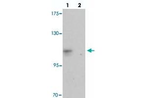 Western blot analysis of CASKIN2 in HeLa cell lysate with CASKIN2 polyclonal antibody  at 1 ug/mL in (lane 1) the absence and (lane 2) the presence of blocking peptide. (CASKIN2 antibody  (N-Term))