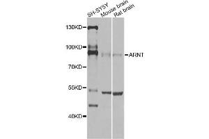 Western blot analysis of extracts of various cell lines, using ARNT Antibody (ABIN5970360) at 1/1000 dilution. (ARNT antibody)