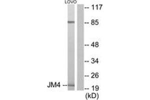 Western blot analysis of extracts from LOVO cells, using JM4 Antibody.