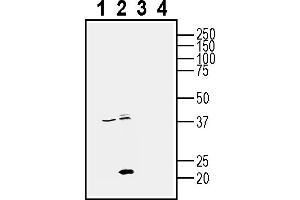 Western blot analysis of human PC3 prostate adenocarcinoma cell line lysates (lanes 1 and 3) and human MDA- breast adenocarcinoma cell line lysate (lanes 2 and 4):1-2. (CD81 antibody  (Extracellular))