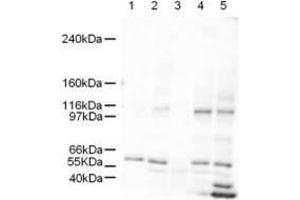 Western blot using  Affinity Purified anti-SmarcAL1 antibody shows detection of a band ~106 kDa band (arrowhead) corresponding to SmarcAL1 in human derived cultured cell lysates (HeLa nuclear extract lane 1, HeLa lane 2, A431 lane 3, Jurkat lane 4, and 293 lane 5). (SMARCAL1 antibody  (AA 80-96))