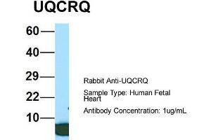 Host: Rabbit  Target Name: UQCRQ  Sample Tissue: Human Fetal Heart  Antibody Dilution: 1. (UQCRQ antibody  (Middle Region))