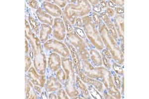 Immunohistochemistry of paraffin-embedded mouse kidney using USO1 Rabbit mAb (ABIN7271234) at dilution of 1:25 (40x lens). (USO1 antibody)