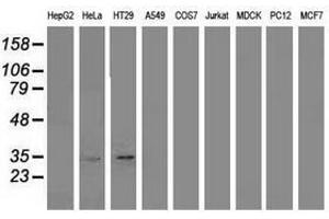 Image no. 1 for anti-Annexin A3 (ANXA3) antibody (ABIN1496643) (Annexin A3 antibody)