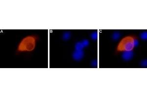 Expression of TRPV1 in rat DRG primary culture - Immunocytochemical staining of paraformaldehyde-fixed and permeabilized rat dorsal root ganglia (DRG) primary cells with Anti-TRPV1 (VR1) Antibody (ABIN7043841, ABIN7043988 and ABIN7043989), (1:200). (TRPV1 antibody  (C-Term, Intracellular))