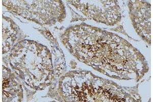 ABIN6269276 at 1/100 staining Mouse testis tissue by IHC-P. (VASP antibody  (Internal Region))