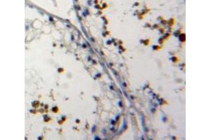 Used in DAB staining on fromalin fixed paraffin-embedded testis tissue (NUP62 antibody  (AA 186-432))