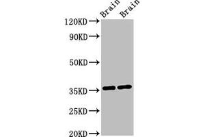 Western Blot Positive WB detected in: Mouse brain tissue, Rat brain tissue All lanes: NIT1 antibody at 3 μg/mL Secondary Goat polyclonal to rabbit IgG at 1/50000 dilution Predicted band size: 36, 32, 41, 35, 27 kDa Observed band size: 36 kDa (Nitrilase 1 antibody  (AA 1-243))