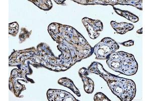 IHC analysis of CD14 using anti-CD14 antibody (ABIN7600531). (CD14 antibody  (AA 20-259))