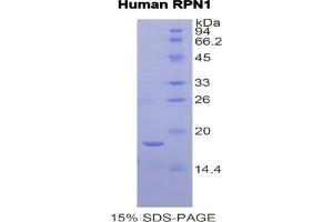 SDS-PAGE analysis of Human Ribophorin I Protein.