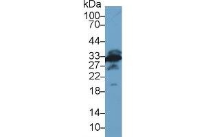 Detection of GAL3 in Mouse Testis lysate using Polyclonal Antibody to Galectin 3 (GAL3) (Galectin 3 antibody)